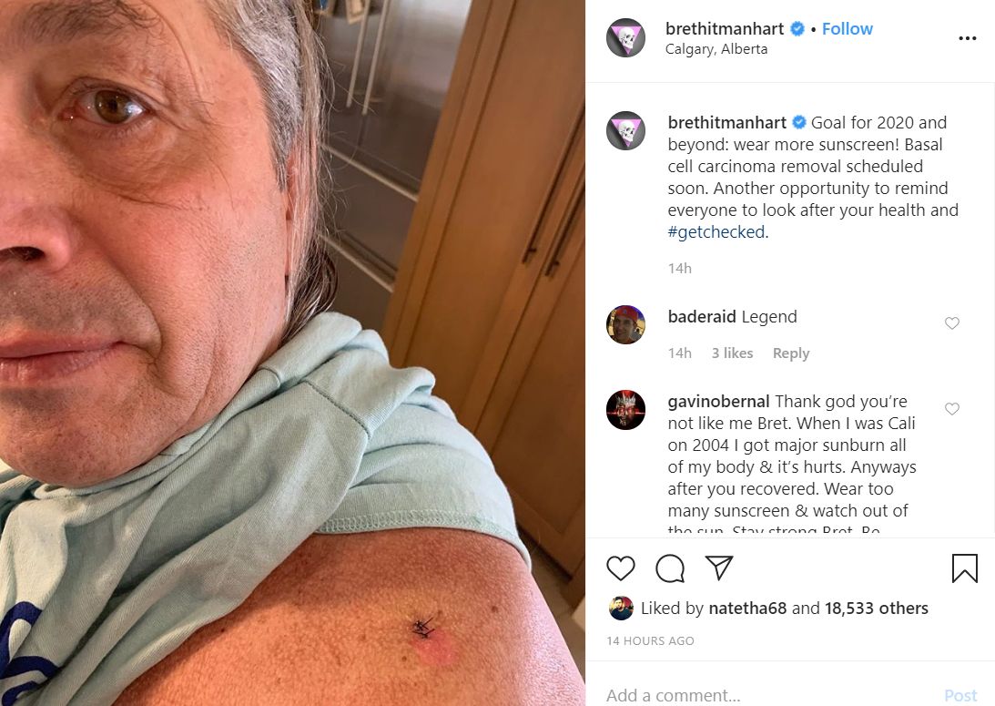 Bret Hart
