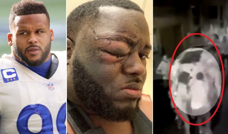 New Video Shows Aaron Donald Was Actually Hero In Fight (Video)