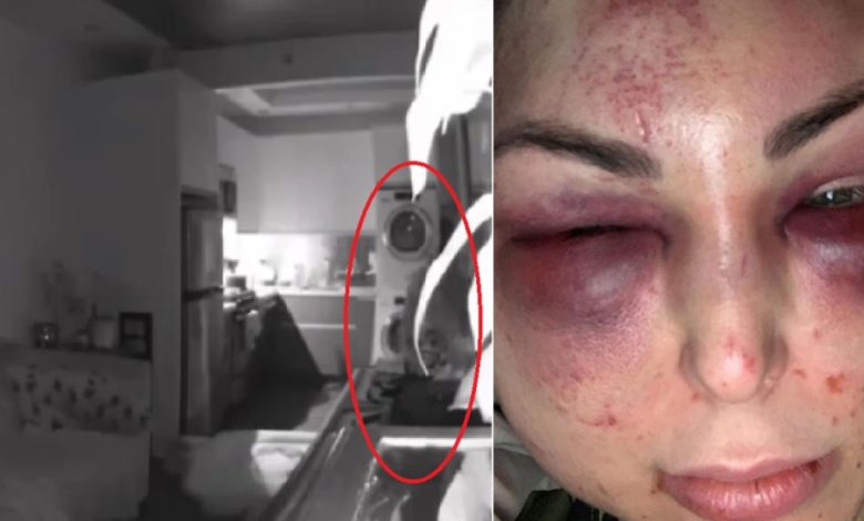 Ex-Lakers Player Responds To Video Of GF Allegedly Being Beaten