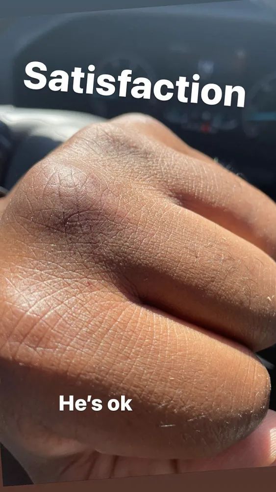 Man Tries To Rob UFC Star Derrick Lewis, Pays The Price (Photos) 1