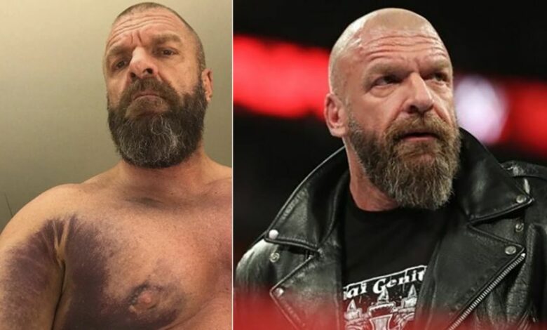 Scary Details Of Paul “Triple H” Levesque’s ‘Cardiac’ Issue Emerge