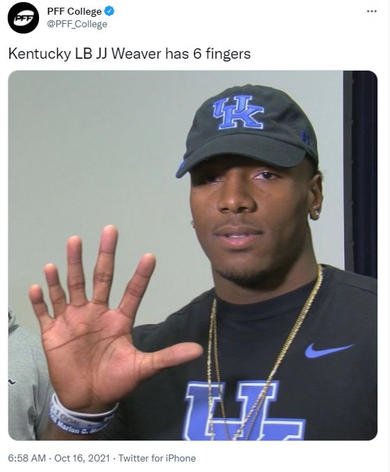 Kentucky’s JJ Weaver Has 6 Fingers On 1 Hand (Photos) 1