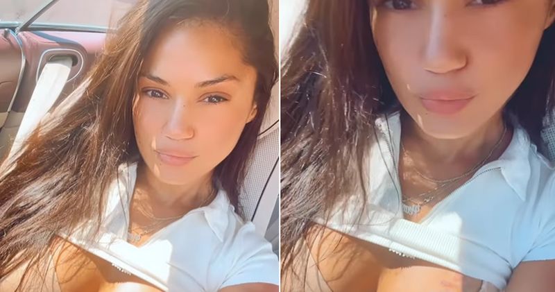 Ex-UFC Star Pearl Gonzalez Shares Chest Tattoo Removal Video