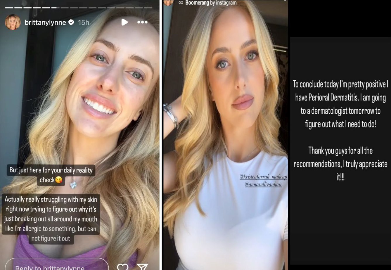 Brittany Mahomes Reveals Unfortunate Health Diagnosis 1